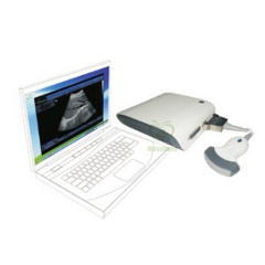 MY-A010 Ultrasound B Scanner Box(with 3D imaging,ultrasond,black white,scanner)