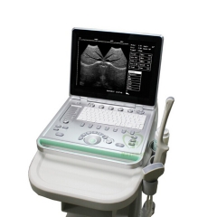 MY-A009C High Cost-effective Portable Laptop Ultrasound Scanner