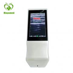 MY-A024Z portable handheld wireless color doppler ultrasound scanner device