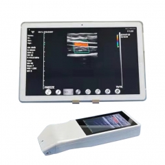 MY-A024Z portable handheld wireless color doppler ultrasound scanner device