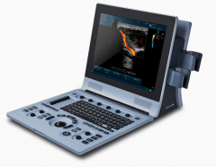 U60 Portable color Doppler ultrasound