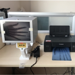MY-D001C fluoroscopy X-ray machine