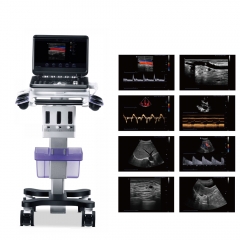 MY-A032A-C Portable Color Doppler Ultrasound Diagnostic System