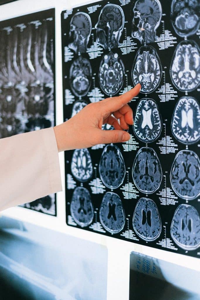 A doctors hand points to a brain MRI scan on a lightbox, illustrating medical diagnosis.