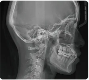 Lateral Cephalogram (Full Size)